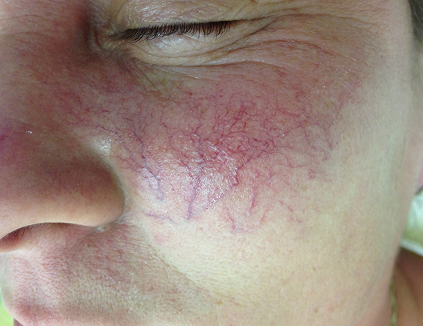 before after gallery