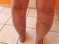 before after gallery